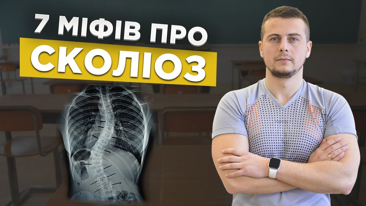 7 міфів про сколіоз
