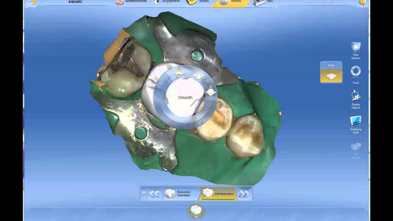 Cerec Omnicam endocrown rubberdam by Cerecfriend.mp4