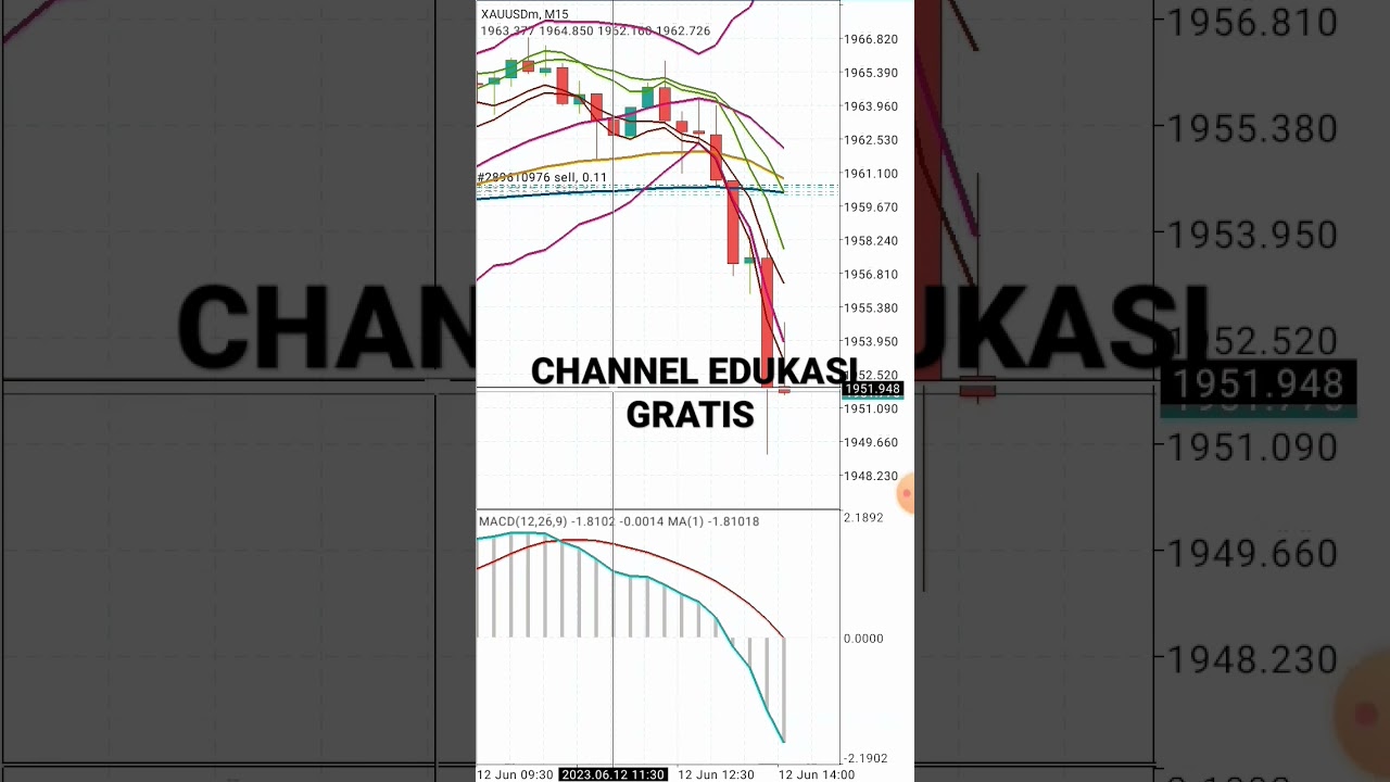 BBMA OMA ALLY TEKNIK SCALPING TERBAIK #bbmaomaally #tradingstrategy #tradingforex