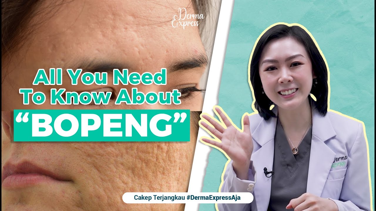 MUKA BOPENG BISA JADI MULUS LAGI! - All You Need To Know About by @derma_express