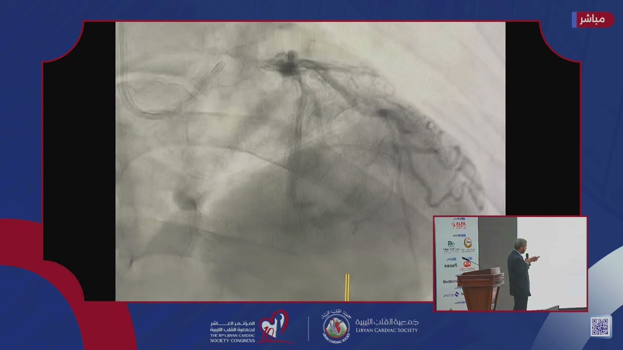 Day 2: Interventional Cardiology I: Challenges in Heart Failure