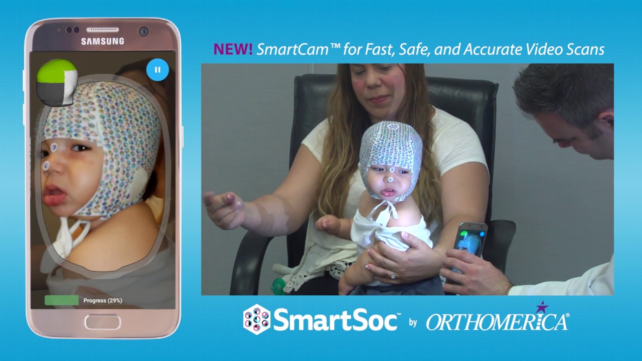 SmartSoc® SmartCam™ for Fast, Safe, and Accurate Video Scans