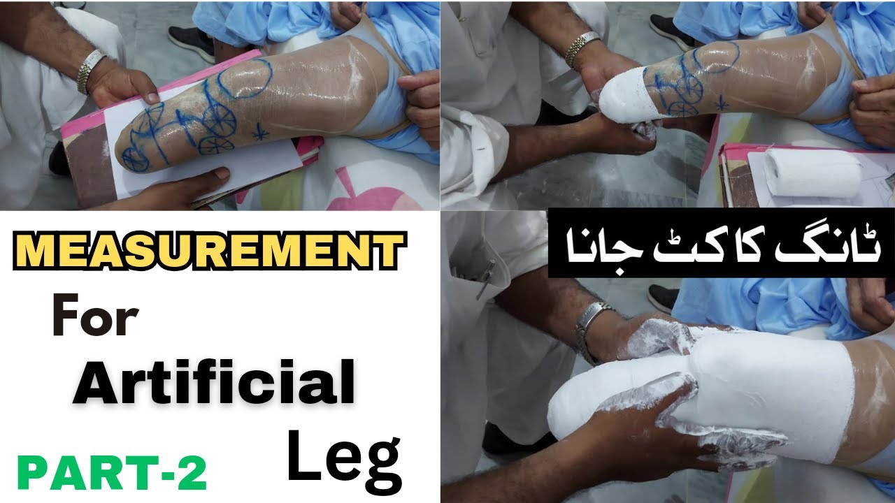 How do you measure for a prosthetic leg | مصنوعی ٹانگ بنانے، کے لیے سائز کیسے لیں؟ #legamputee