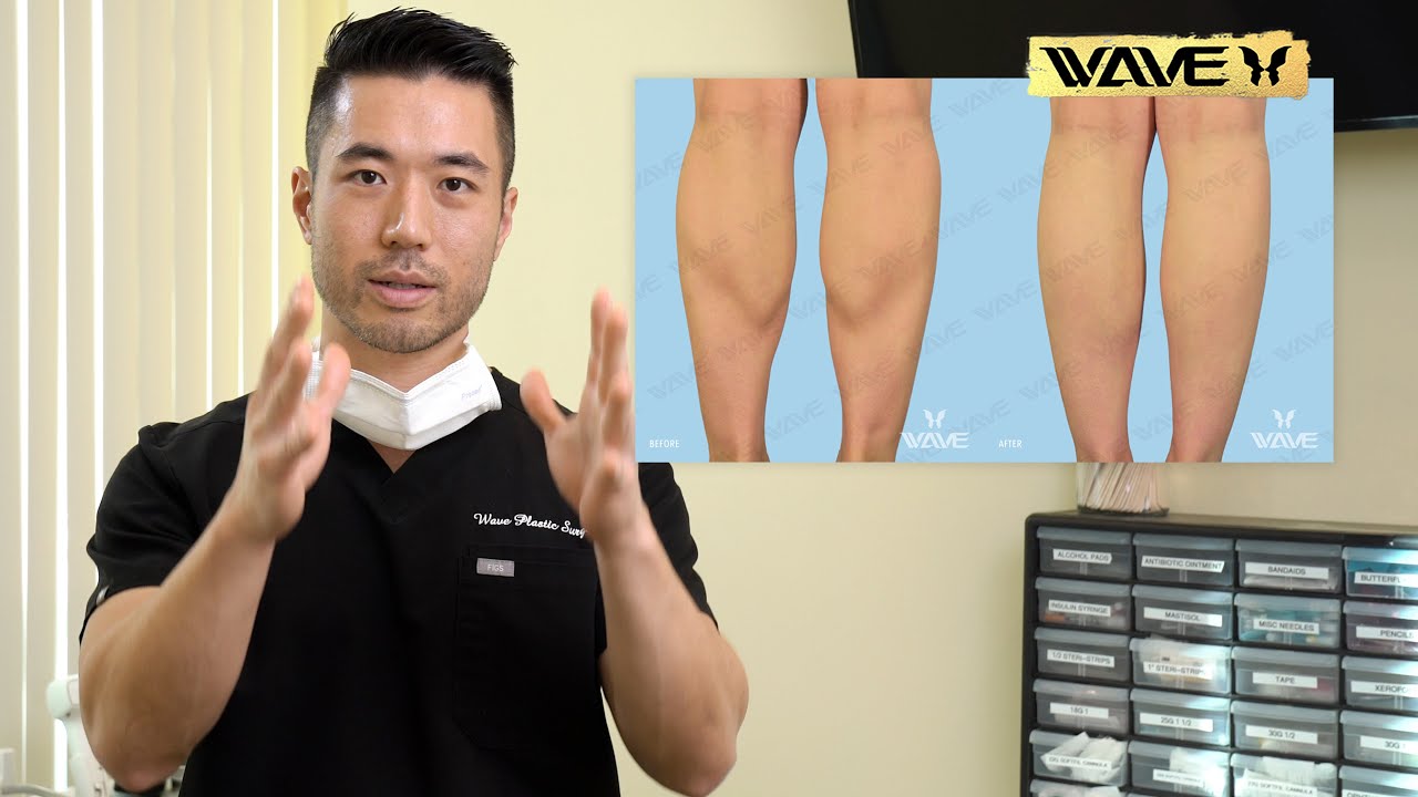 This is what I use to Reduce your Calf Size | Wave Plastic Surgery