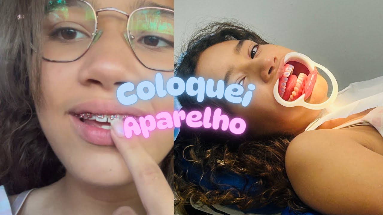 Coloquei aparelho✋😝🤚