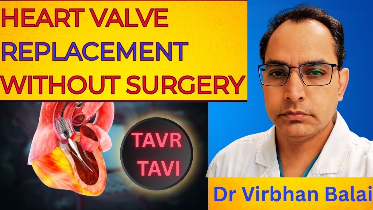 “TAVR / TAVI Procedure Explained | Heart Valve Replacement Without Open Surgery | Dr. Virbhan Balai