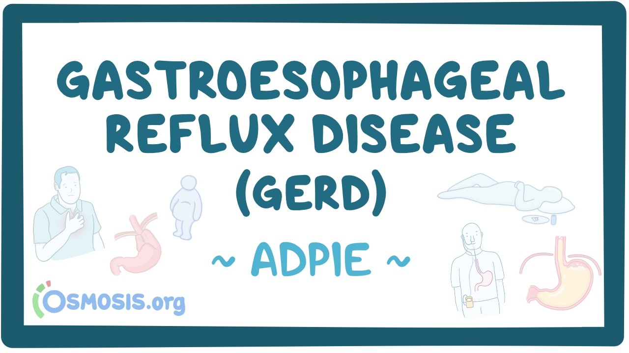 Gastroesophageal reflux disease (GERD): Nursing Process (ADPIE)