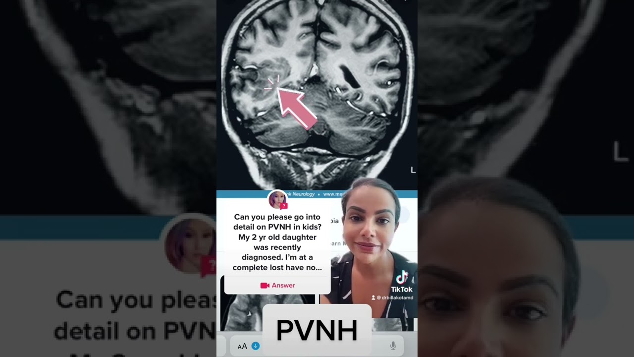 Periventricular Nodular Heterotopias