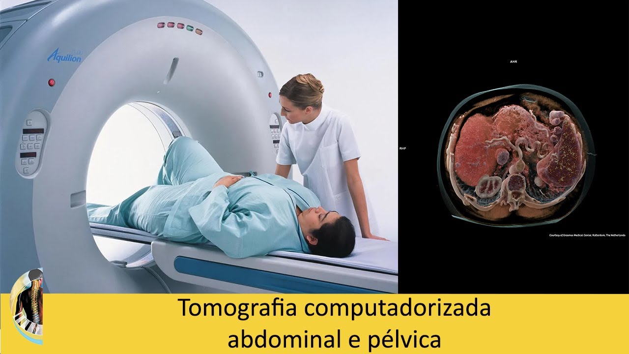 Tomografia computadorizada abdominal e pélvica