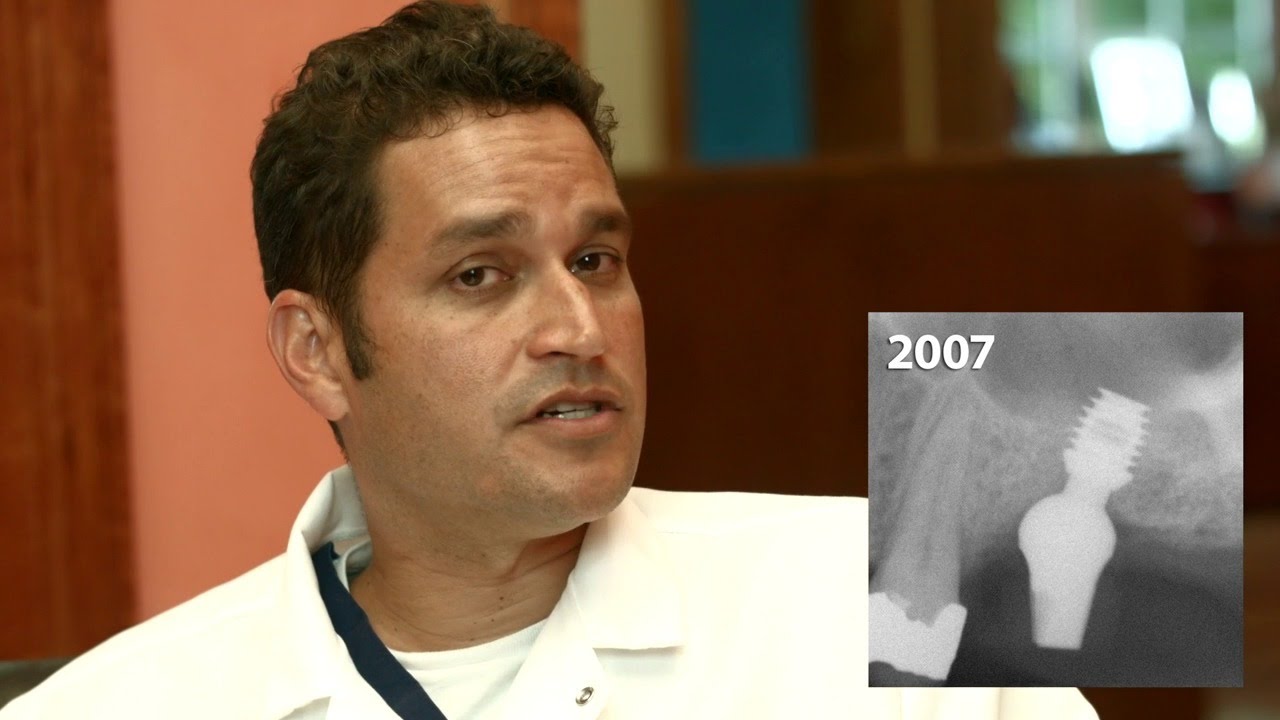 The Implant Book was Wrong, Longer is Not Better