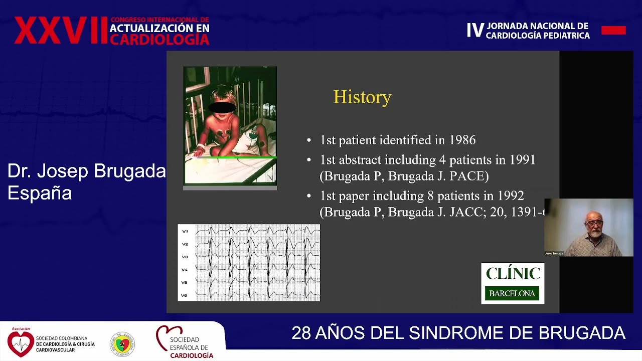 SINDROME DE BRUGADA: Dr JOSEP BRUGADA  