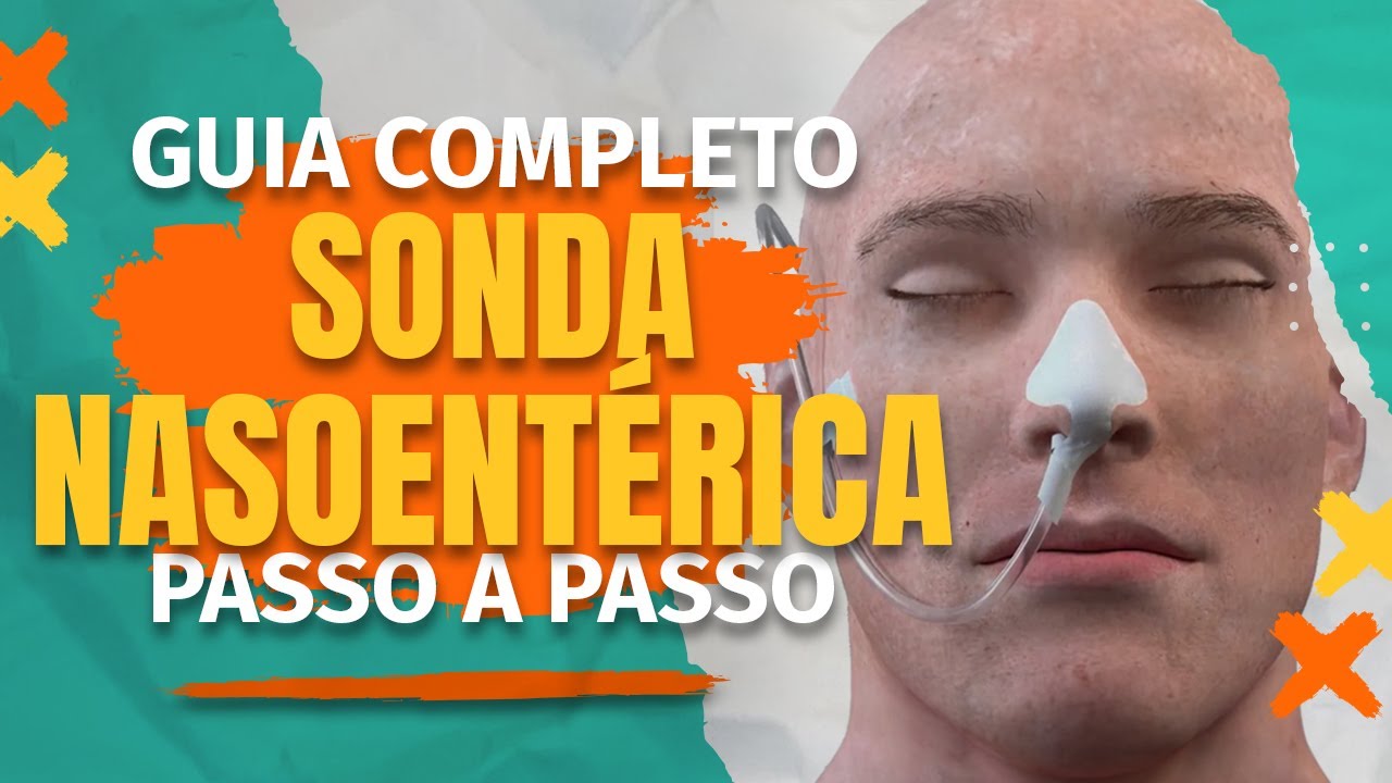 Guia completo sobre Sonda Nasoentérica. Passo a passo-Aula prática