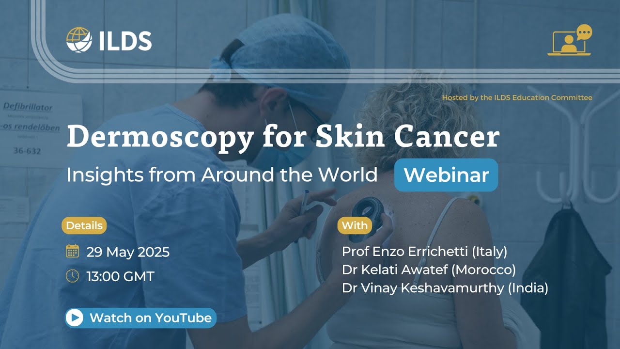 Dermoscopy for Skin Cancer: Insights from Around the World