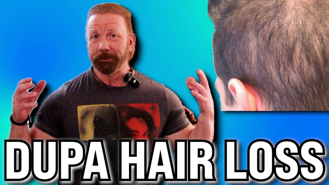 DUPA Hair Loss!