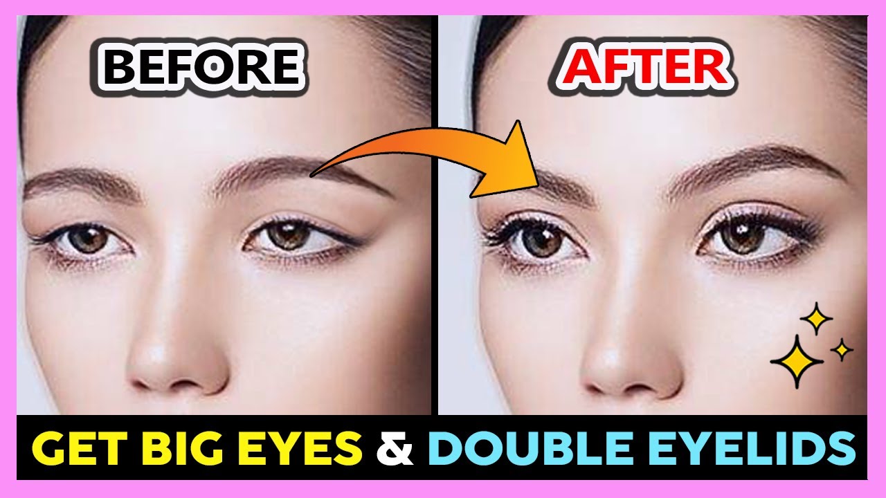✨ ENLARGE BIG EYES MASSAGE, CREATE DOUBLE EYELIDS, EYES BIGGER, FIX DROOPY EYELIDS, EYELIDS LIFT