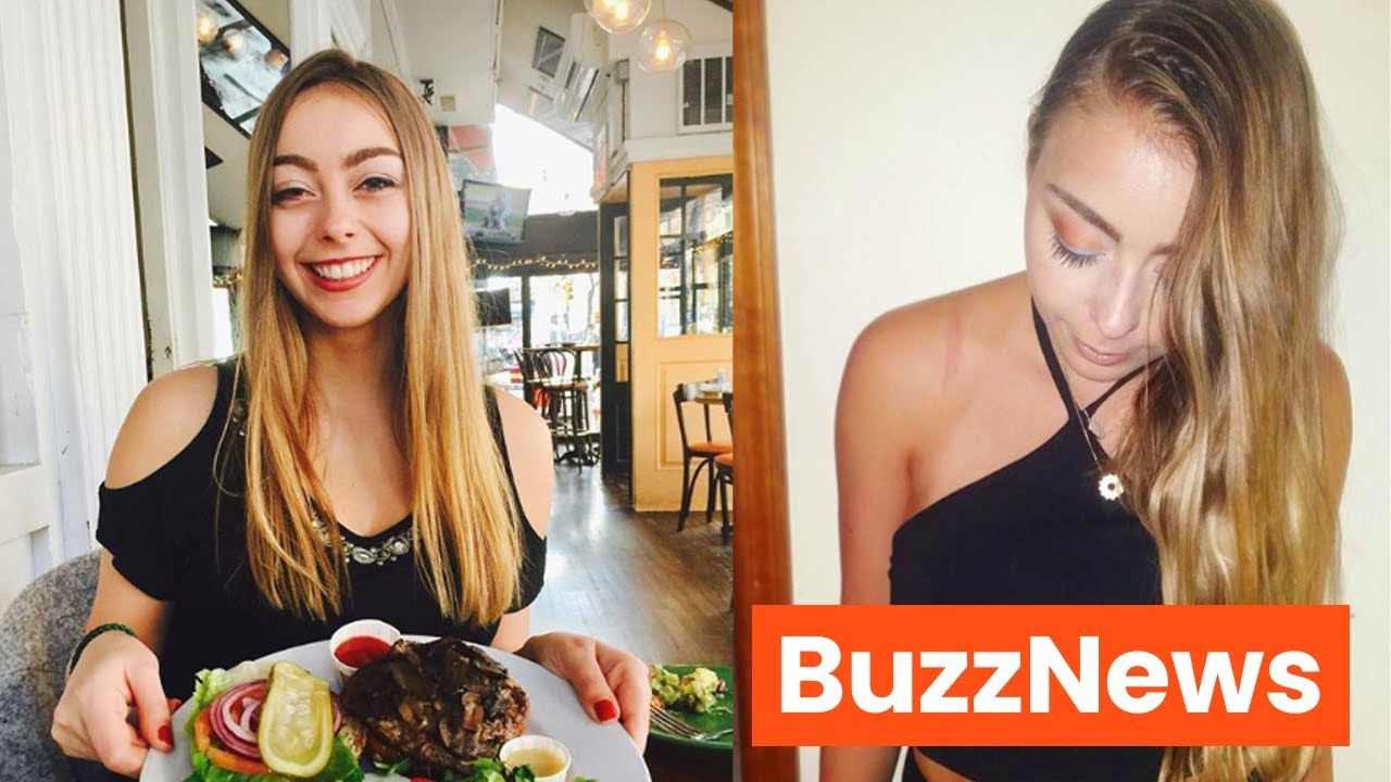 Ma 21 lat i twierdzi, że przez swoją urodę ma trudniej w życiu! | BuzzNews