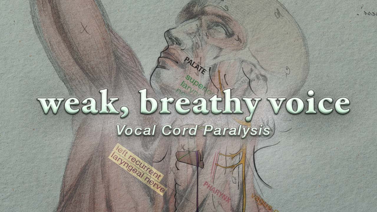 Vocal Cord Paralysis | Diagnosis, Symptoms, and 3 Treatment Methods