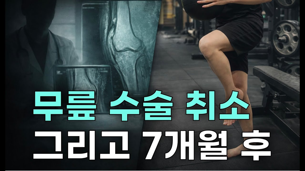 의사선생님이 말렸지만 수술 취소했습니다. 7개월 후 지금 무릎의 상태는요...