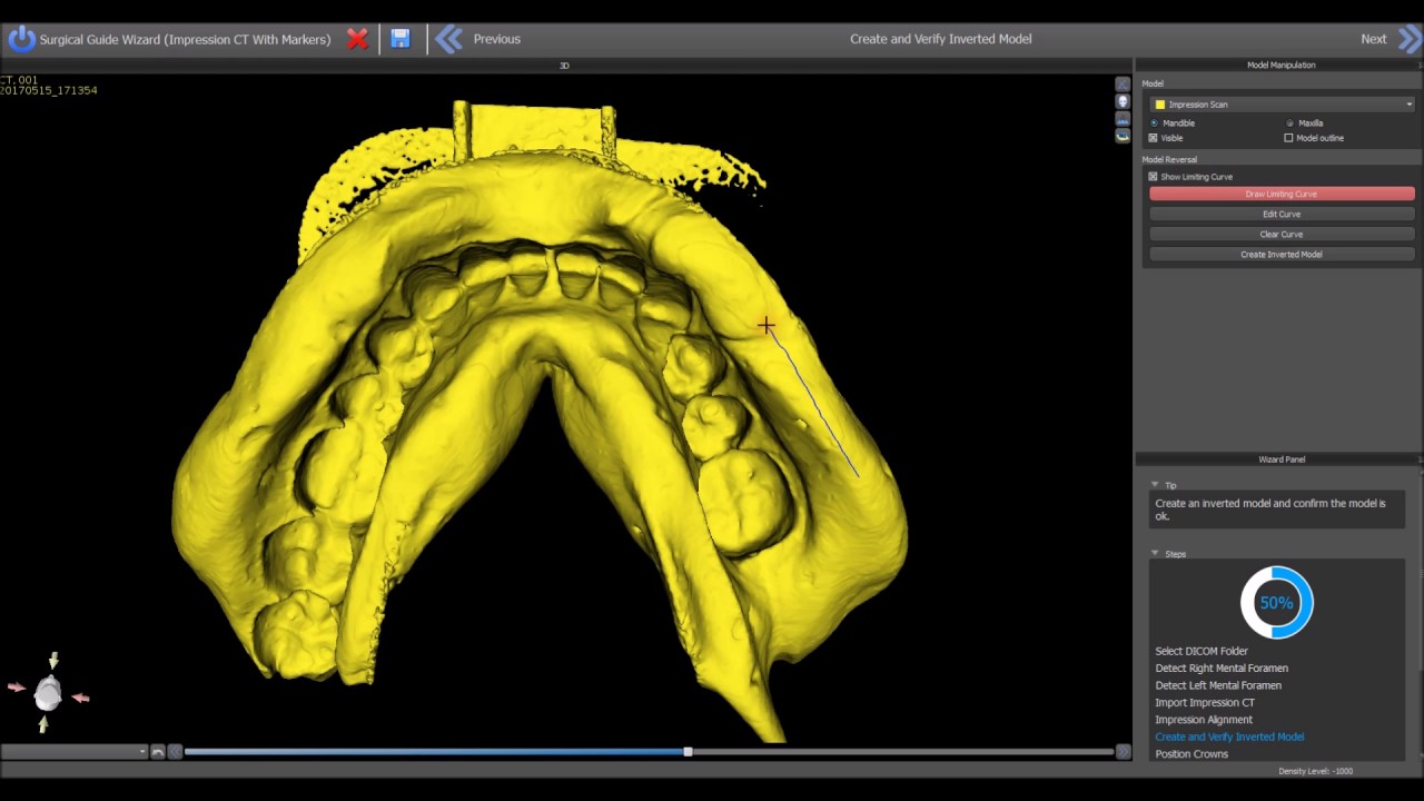 CBCT to Surgical Guide Training Video -  Using the Impression Inversion Protocol
