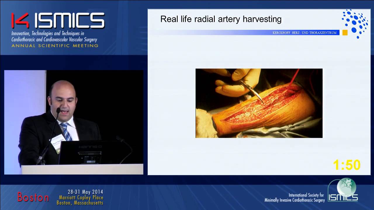 CMP28 Minimal trauma radial artery harvesting