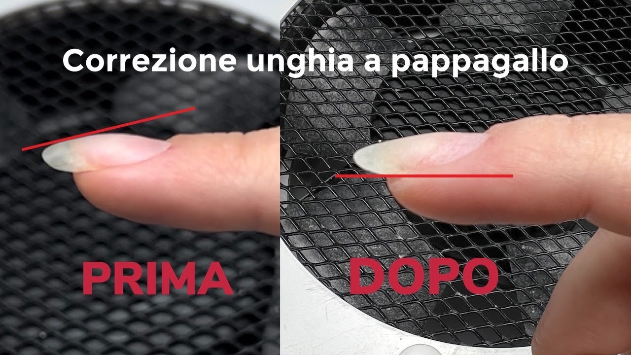 🦜 CORREZIONE UNGHIE ALL'INGIU' FACCIAMOLA INSIEME|Makolina95|