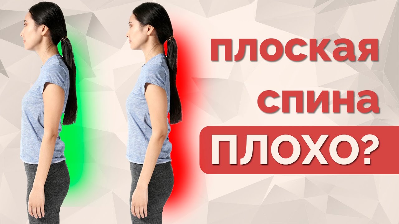 Плоская спина, гиперлордоз. Что опаснее? Как исправить?