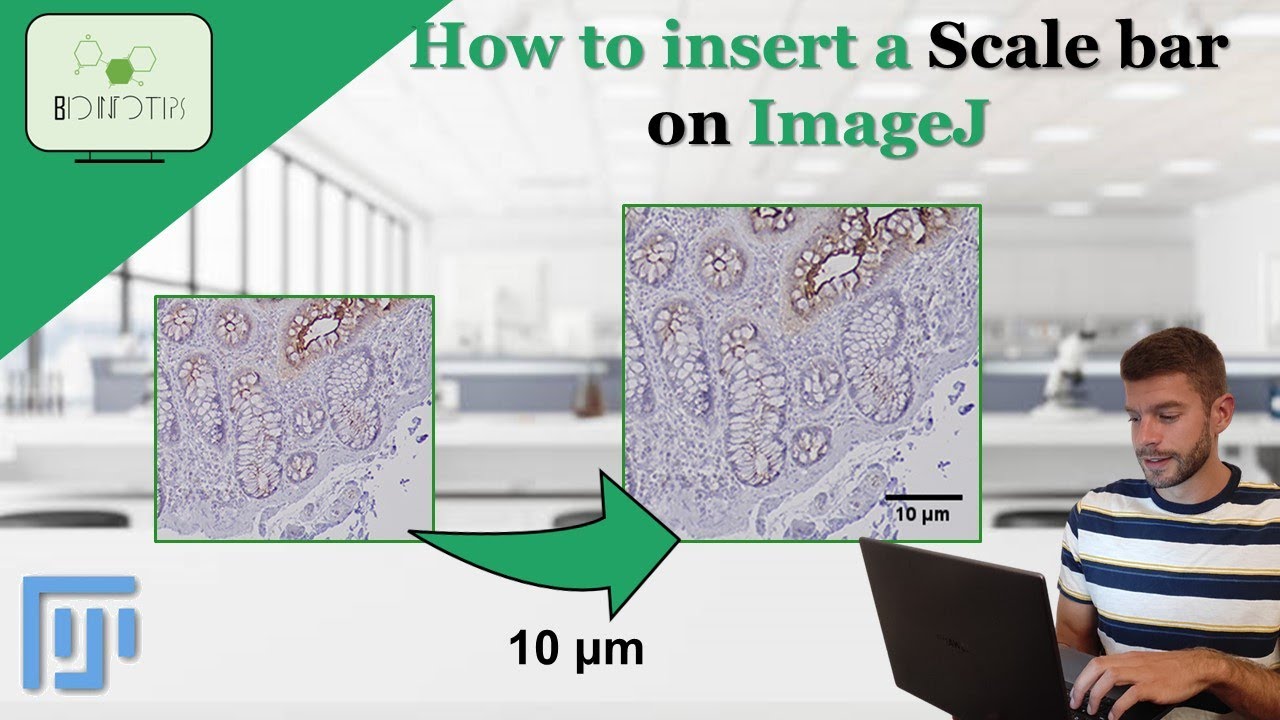 Как вставить масштабную линейку в ImageJ #sclalebar #imagej #tutorial