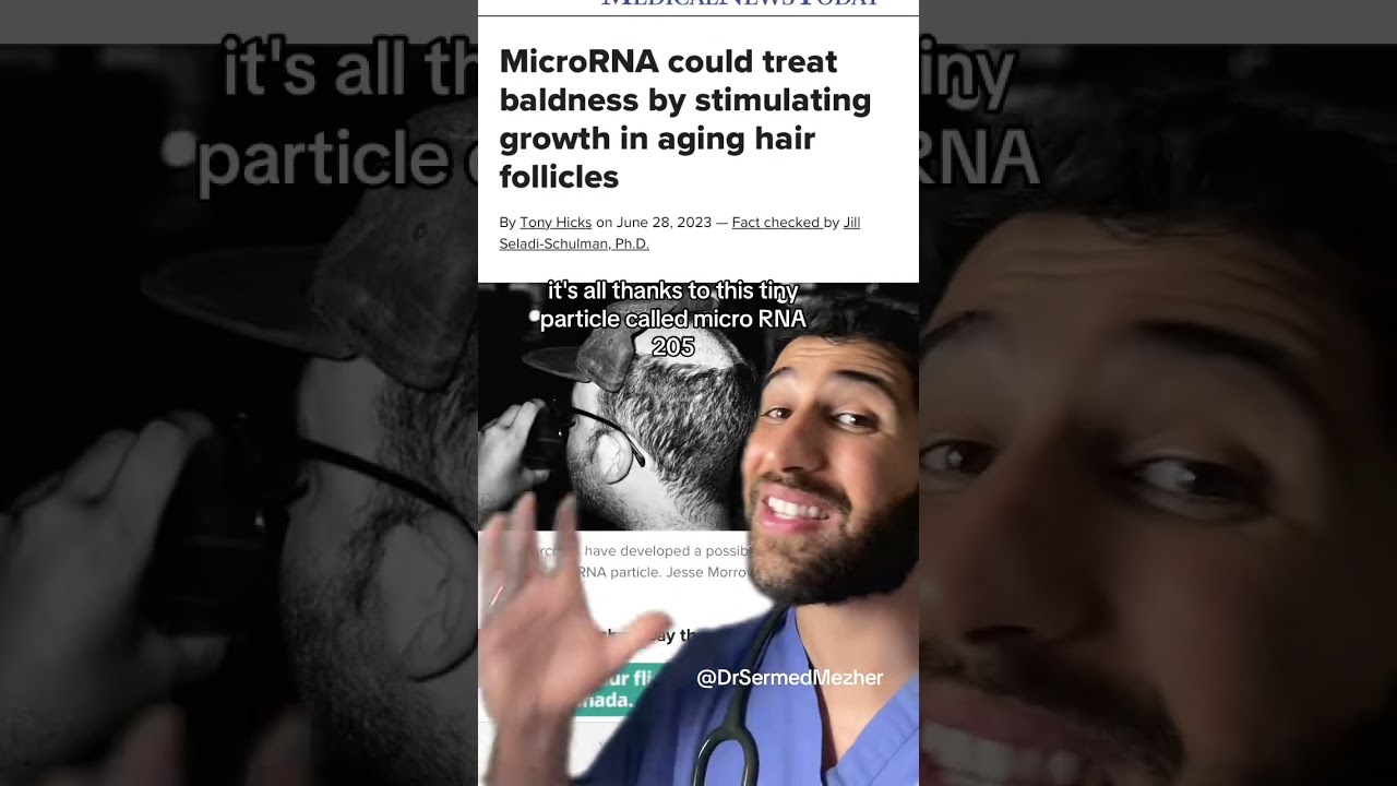 Male Pattern Baldness Could Be Cured Soon Thanks to This Treatment #research Stem cells hold signifi