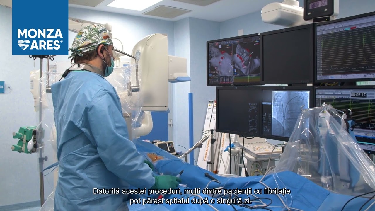 Ablația de fibrilație atrială | Ce este și cum se efectuează procedura | MONZA ARES