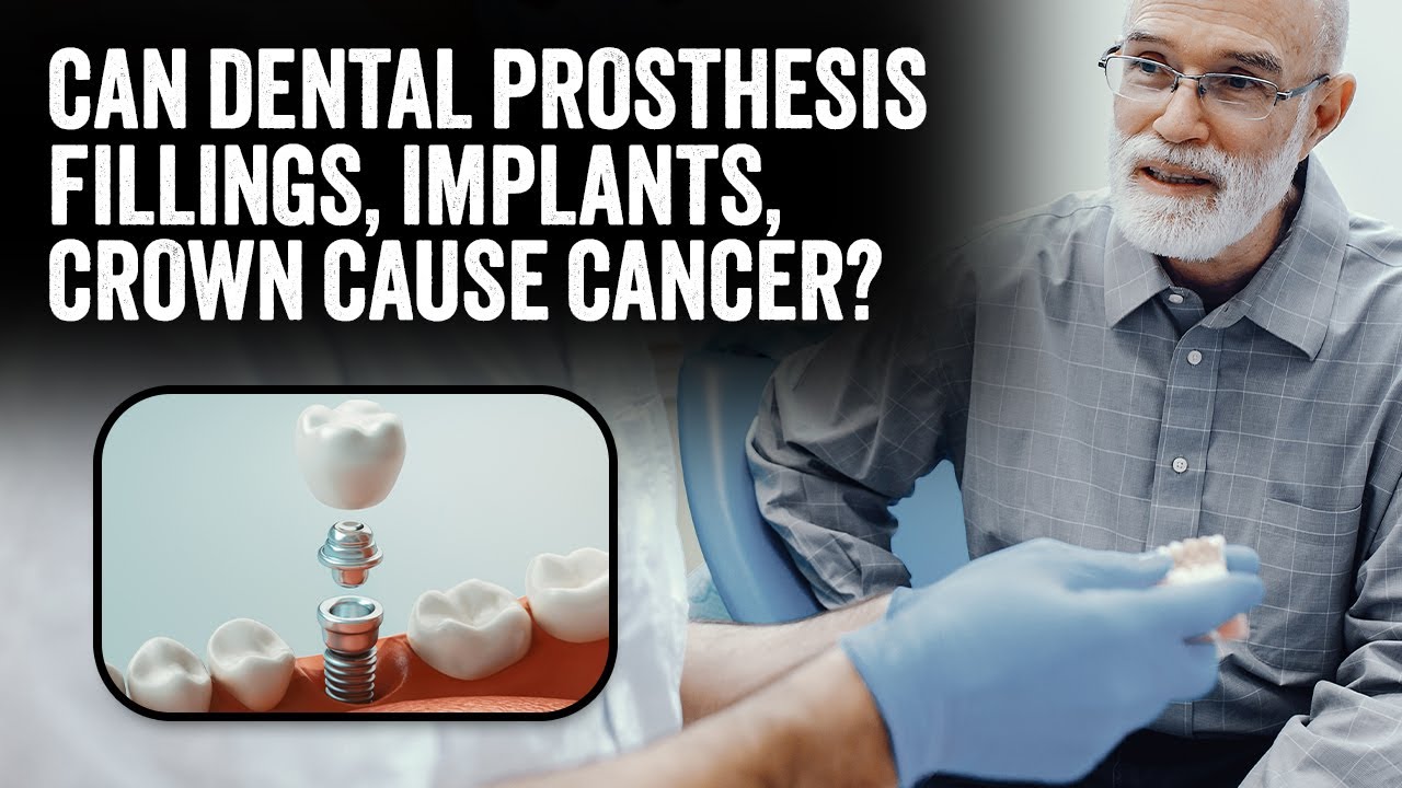 Can Dental prosthesis fillings, implants, crown cause Cancer? AskDrV, Online DentalChat Session