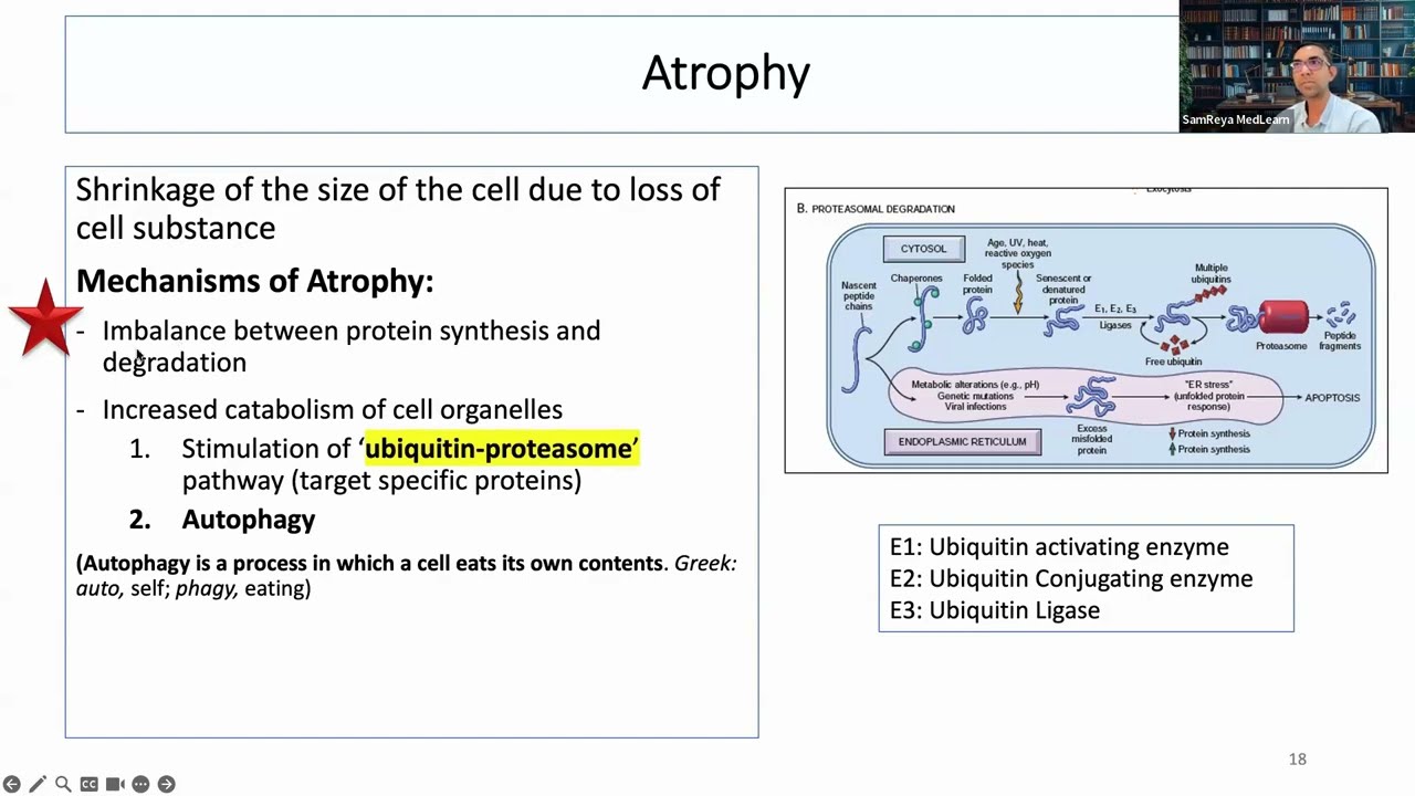 002 Cellular Adaptations part 2: Atrophy and Metaplasia