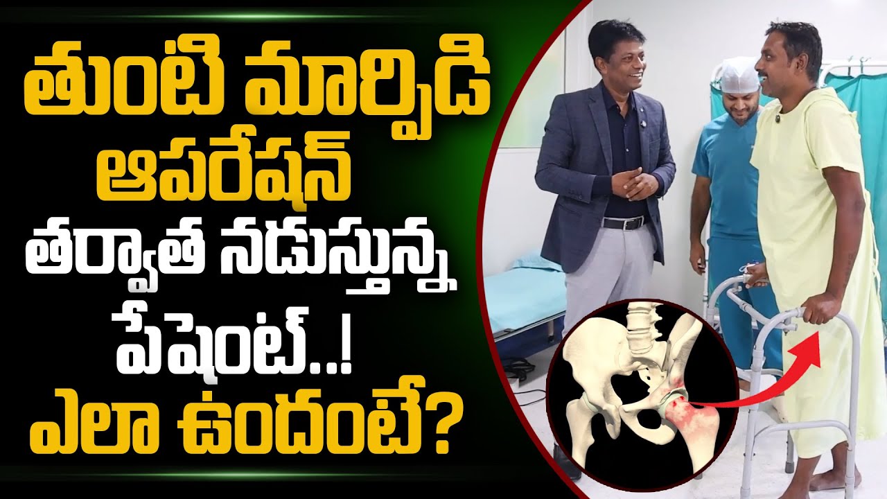 తుంటి మార్పిడి తర్వాత ఎలా ఉందంటే..| Dr Vivekananda Bheemisetty About Hip Replacement | PlayEven