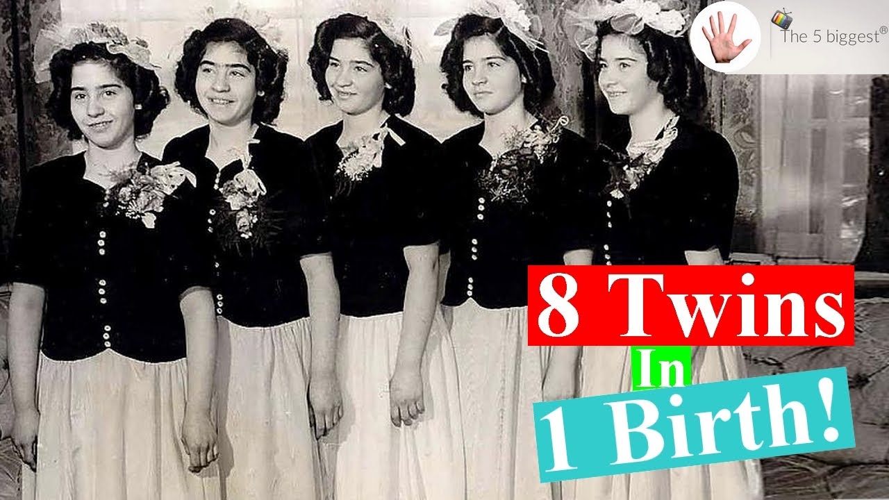 Largest Set of Twins Ever Born In Known History! ~ Body Bizarre!