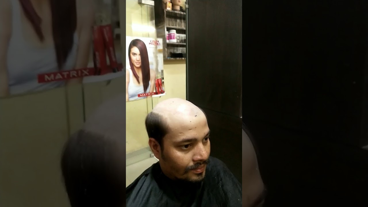Permanent hair patch, Indore MP 91-9926978311,91-9165278657