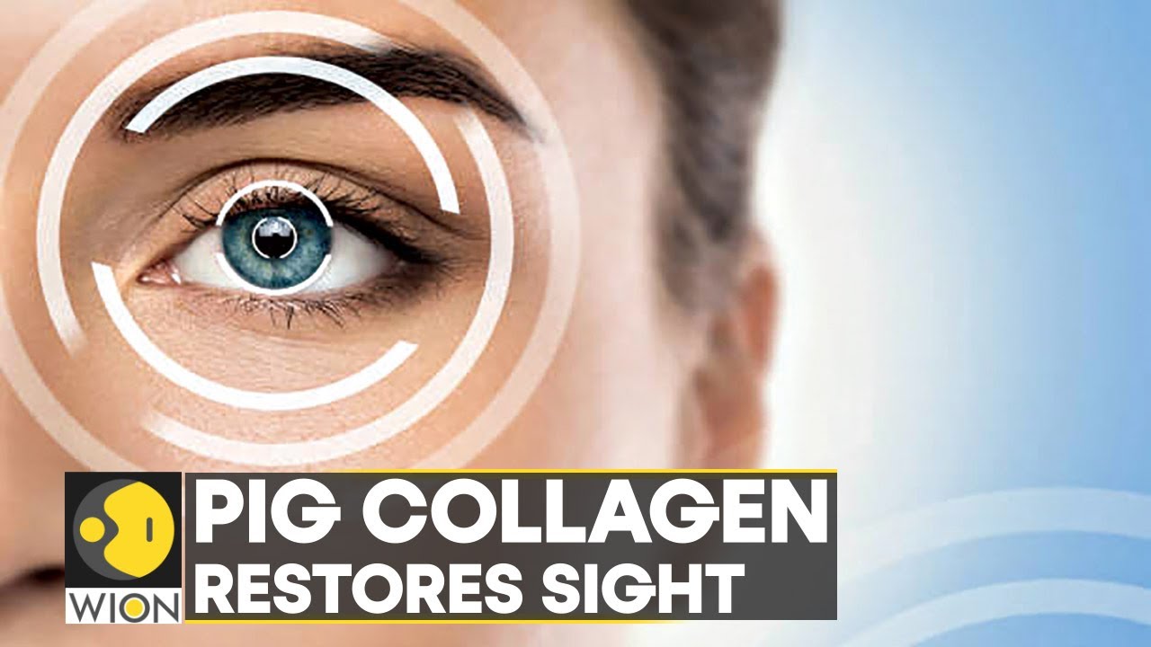 WION Fineprint | Cornea made from pig skin restores sight, minimally invasive treatment