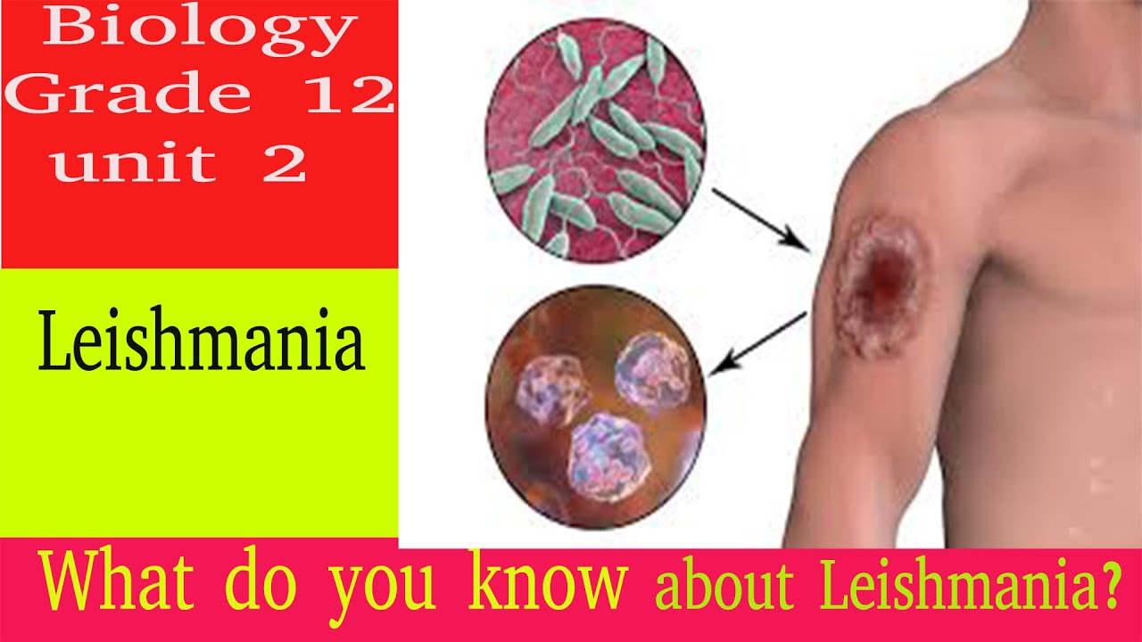 Biology Grade 12 unit 2: Leishmania. What do you know about Leishmania?