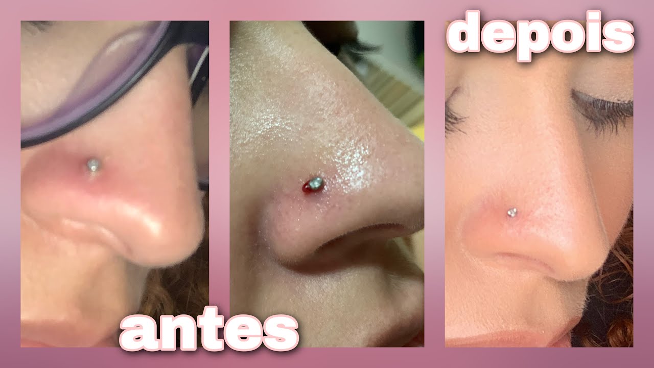 COMO CUIDAR DO PIERCING INFLAMADO - tchau queloide