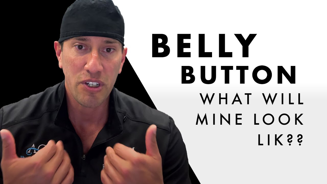What will my belly button look like?