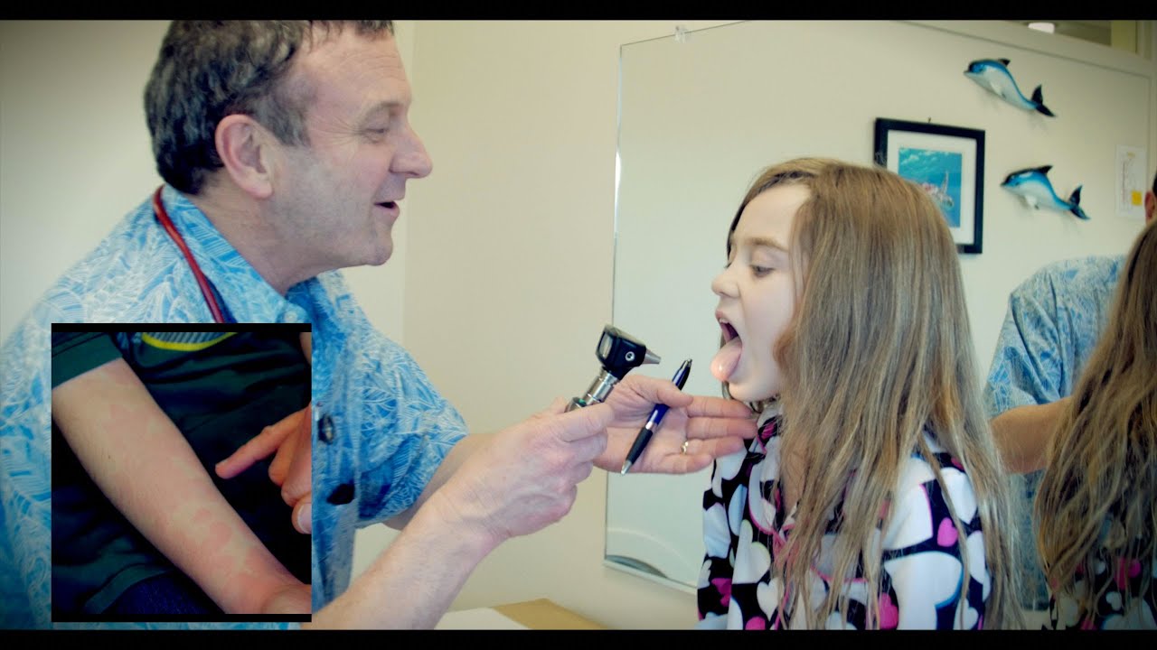 STREP THROAT with HIVES | Live Diagnosis