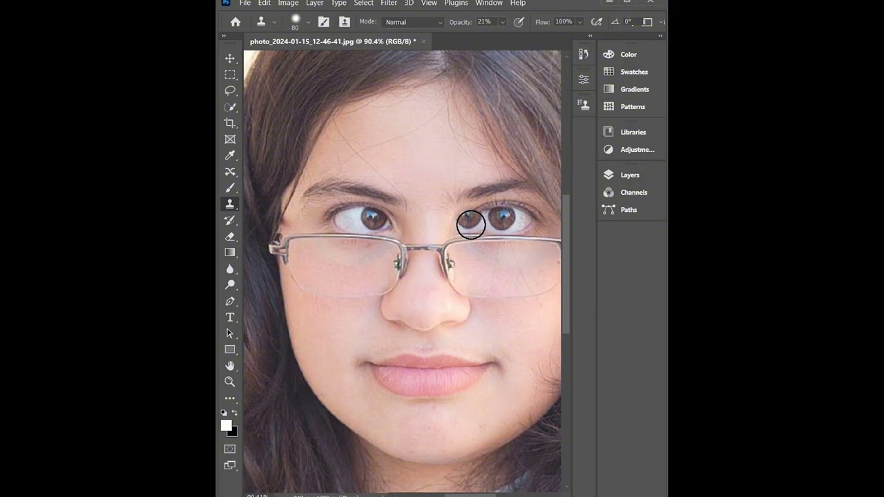 Transform Strabismus Eyes to Perfect Vision with Photoshop
