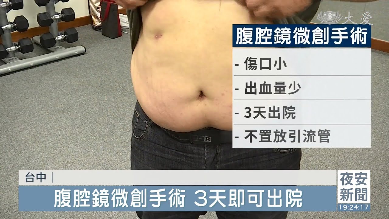 腹腔鏡減重術 後續照護擺脫肥胖