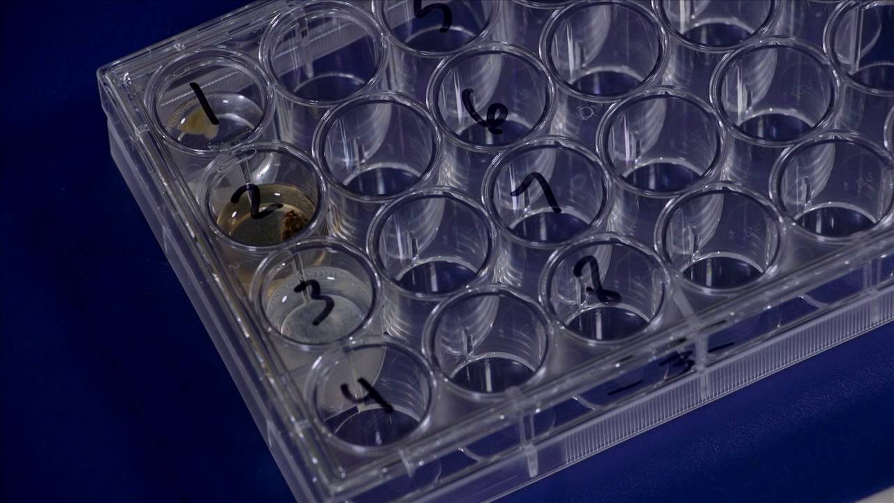 How to make a sponge spicule prep