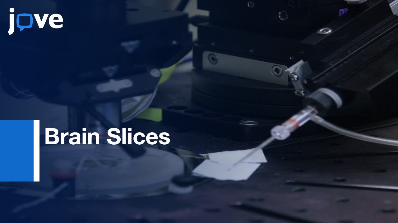 Image-guided Patch Clamp to Study Neurons in Brain Slices | Protocol Preview