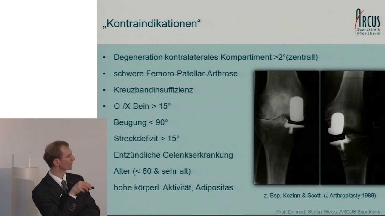 Künstliche Kniegelenke: Was gibt es Neues? - ARCUS Patientenforum