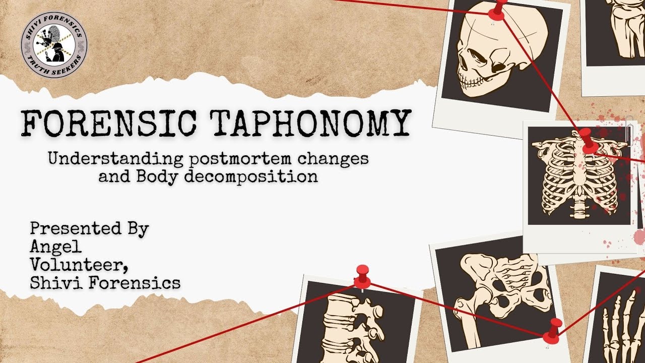 Understanding Postmortem changes & Decomposition #medicine
