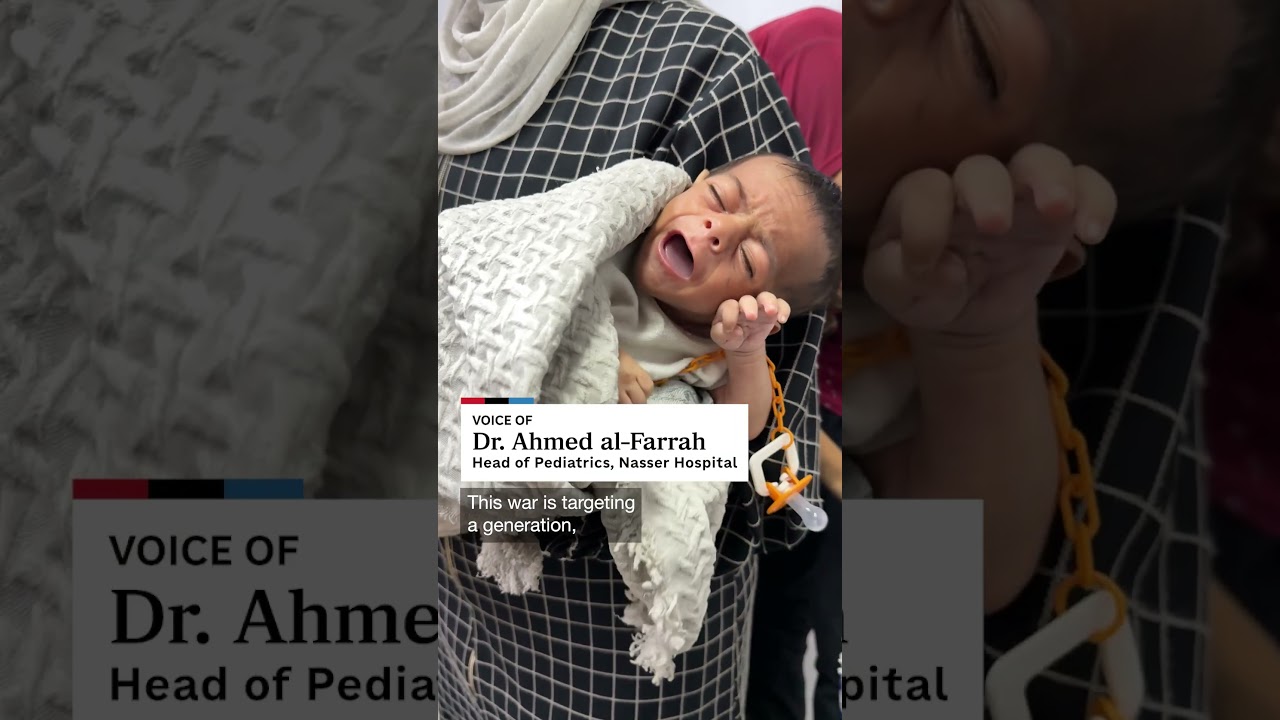 Doctors warn that children in Gaza have suffered irreversible damage from starvation