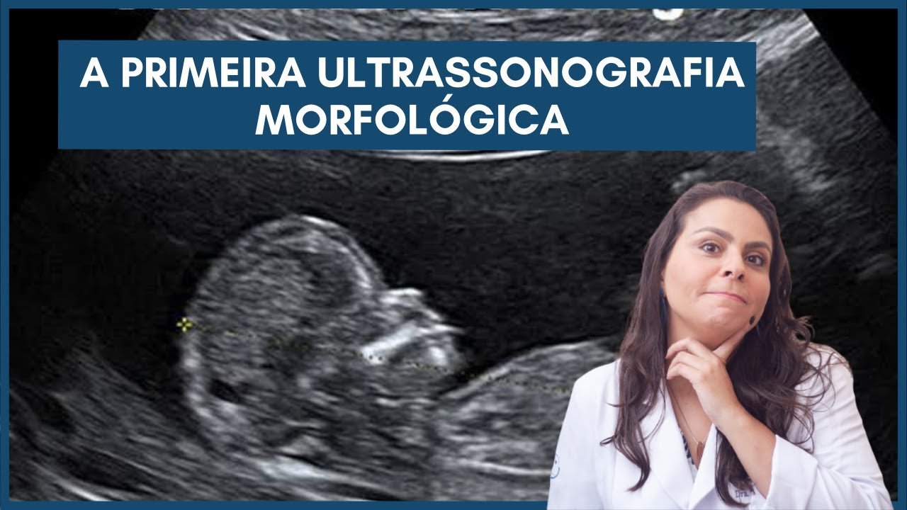 A primeira ultrassonografia morfológica - Dra. Maíra de La Rocque
