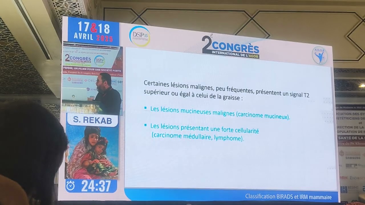 IRM mammaire dr Rakab Journées AGOB