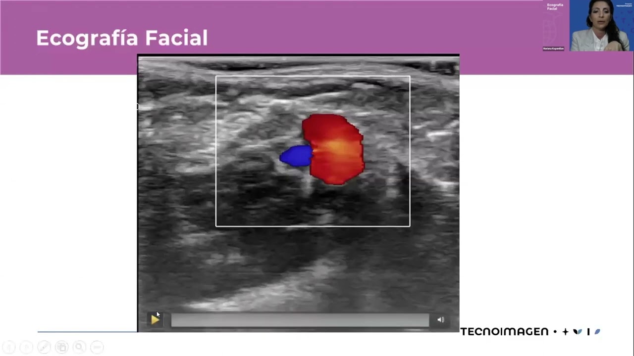 Webinar: Ecografía Facial.