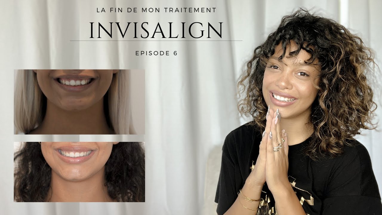 Projet #INVISALIGN - Ep.6 : resultat final et mon expérience